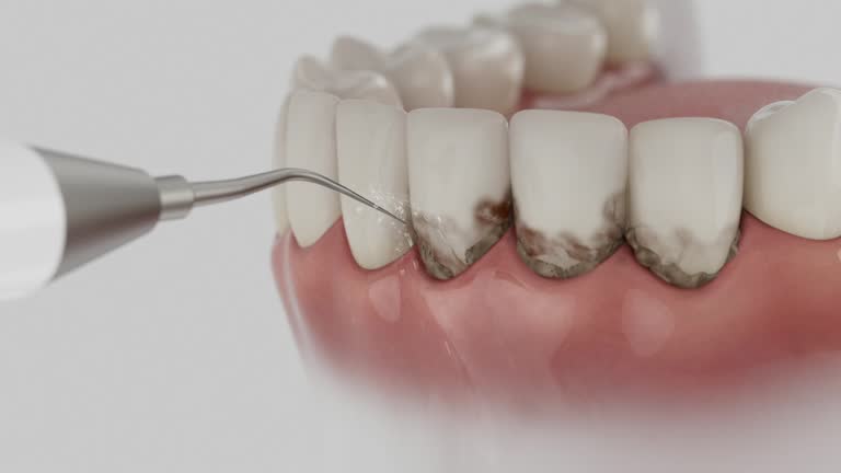 Reliable Dental contractor in Waterville, MN by Smile Center Dentistry